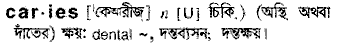 Caries in Bangla Academy Dictionary